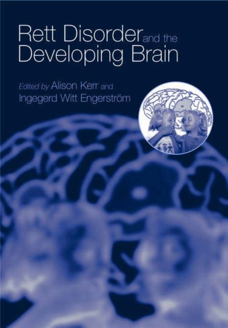 Forsidebilde av Rett Disorder and the Developing Brain