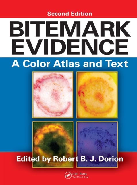 Bitemark Evidence : A Color Atlas and Text, 2nd Edition