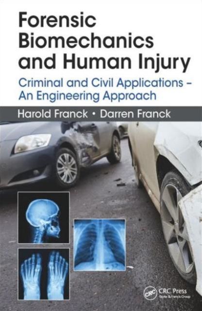 Forensic Biomechanics and Human Injury : Criminal and Civil Applications - An Engineering Approach