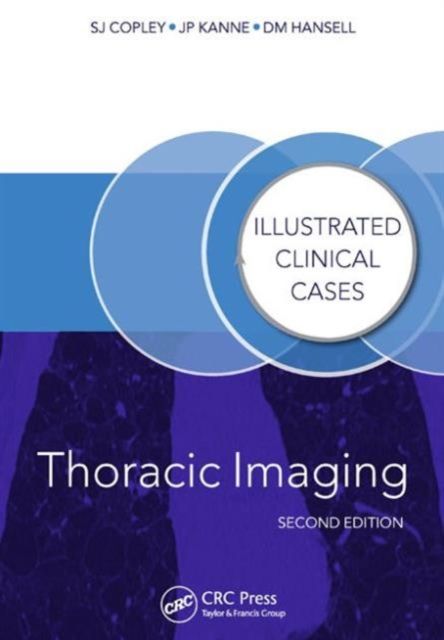 Thoracic Imaging : Illustrated Clinical Cases, Second Edition