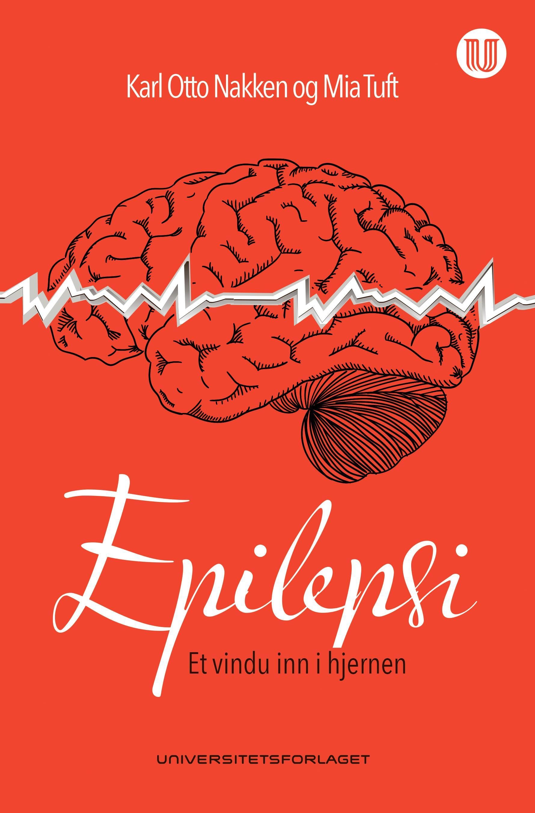 Epilepsi : et vindu inn i hjernen