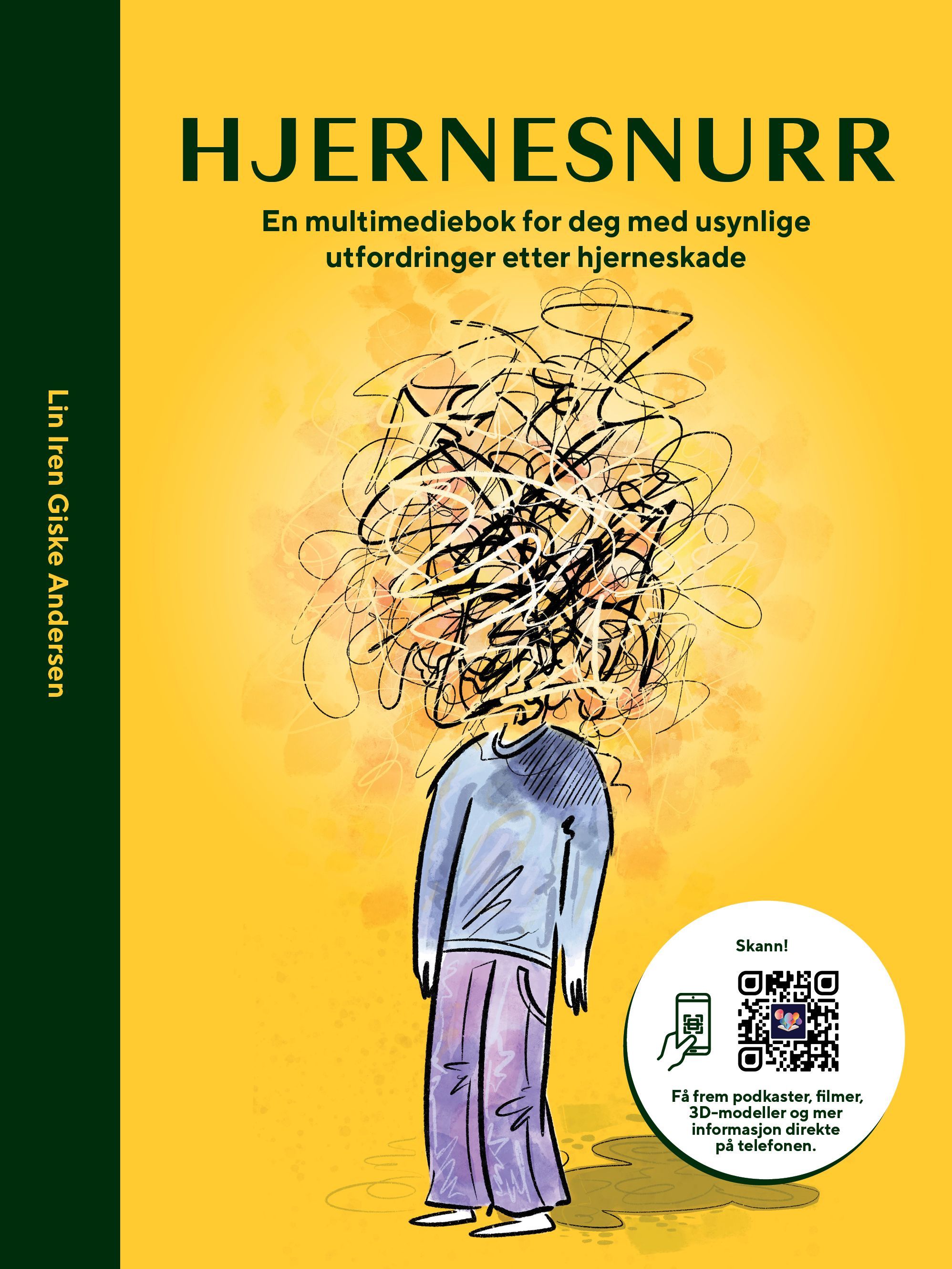 Hjernesnurr