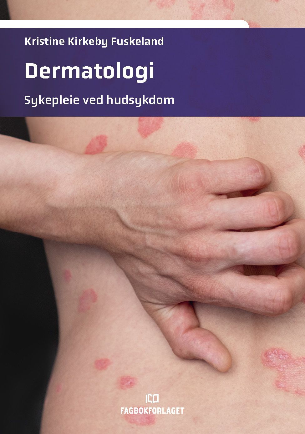 Forsidebilde av Dermatologi : sykepleie ved hudsykdom