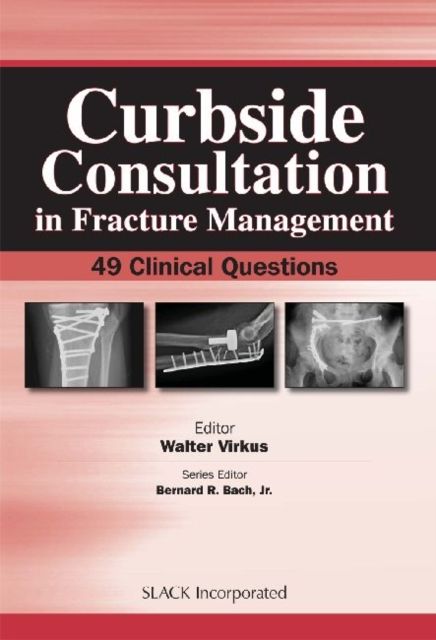 Curbside Consultation in Fracture Management : 49 Clinical Questions