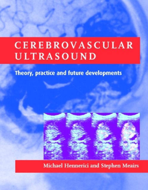 Cerebrovascular Ultrasound : Theory, Practice and Future Developments