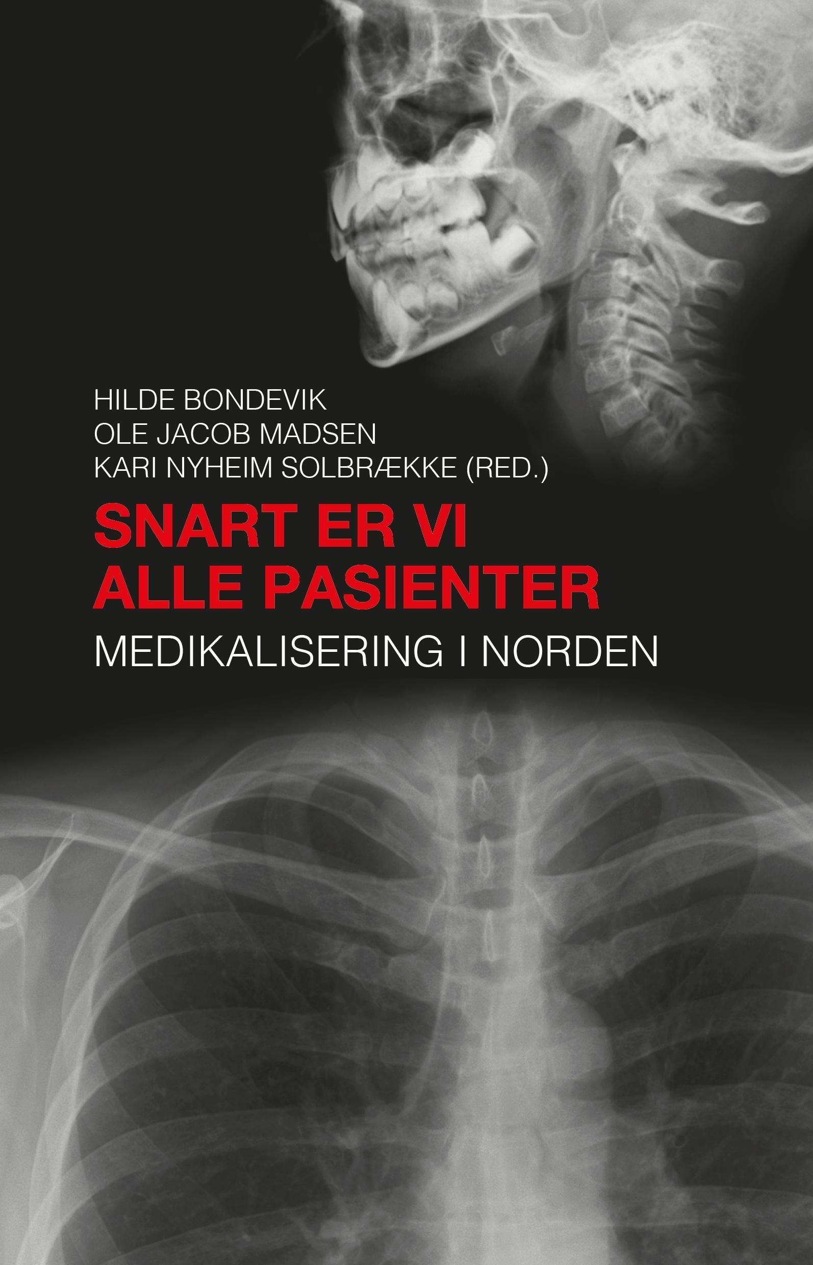Snart er vi alle pasienter : medikalisering i Norden