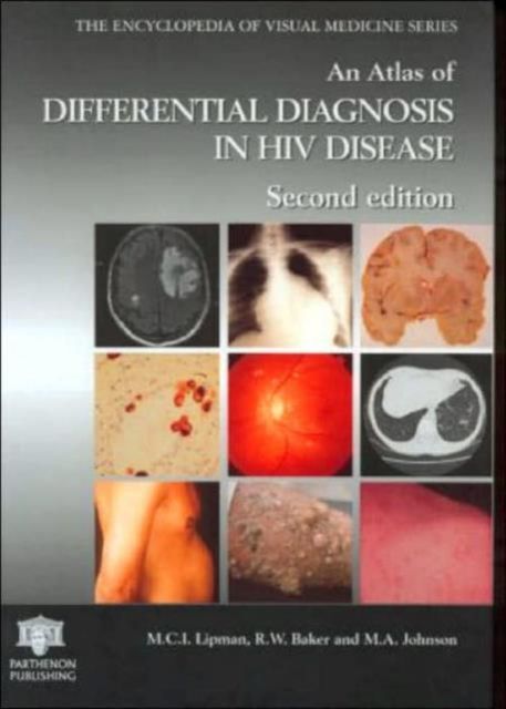 An Atlas of Differential Diagnosis in HIV Disease
