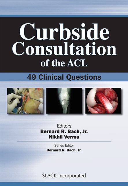 Curbside Consultation of the ACL : 49 Clinical Questions