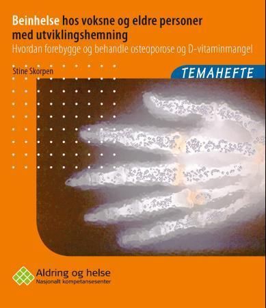 Beinhelse hos voksne og eldre personer med utviklingshemning : hvordan forebygge og behandle osteoporose og D-vitaminmangel