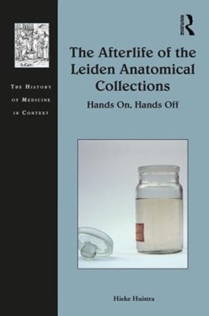 The Afterlife of the Leiden Anatomical Collections : Hands On, Hands Off