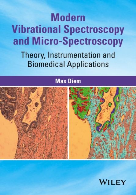 Modern Vibrational Spectroscopy and Micro-Spectroscopy : Theory, Instrumentation and Biomedical Applications