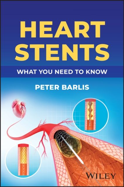 Heart Stents : What You Need to Know