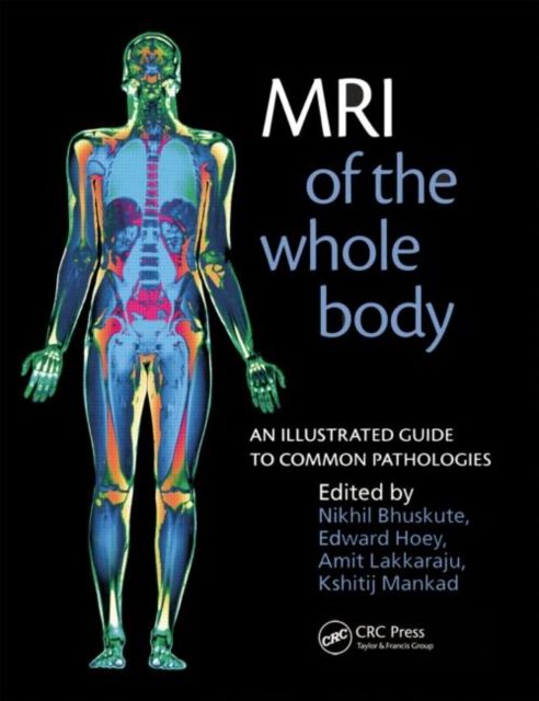 MRI of the Whole Body : An Illustrated Guide for Common Pathologies