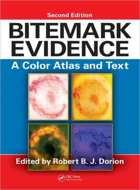 Bitemark Evidence : A Color Atlas and Text, 2nd Edition