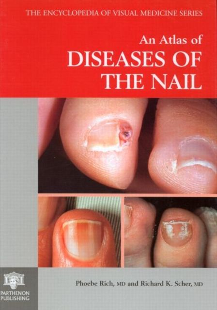 An Atlas of Diseases of the Nail