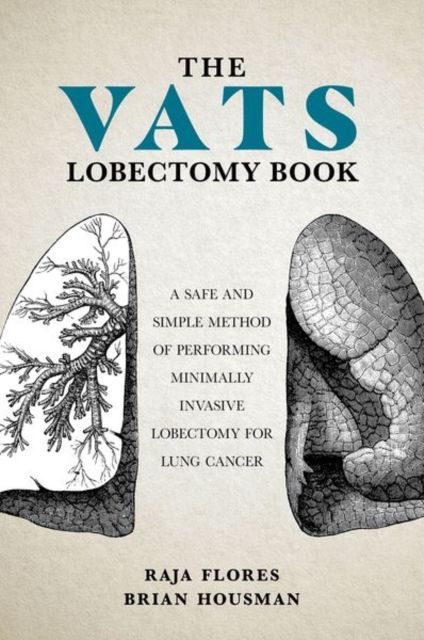 The VATS Lobectomy Book : A Safe and Simple Method of Performing Minimally Invasive Lobectomy for Lung Cancer