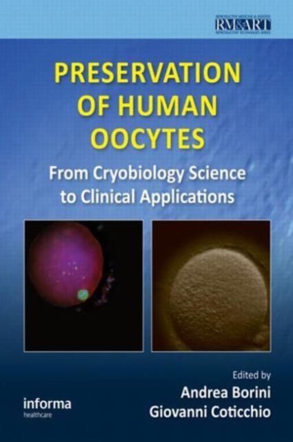 Preservation of Human Oocytes : From Cryobiology Science to Clinical Applications
