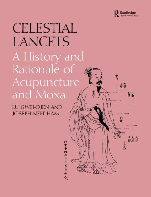 Celestial Lancets : A History and Rationale of Acupuncture and Moxa