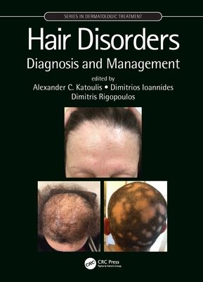 Hair Disorders : Diagnosis and Management