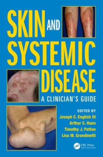 Skin and Systemic Disease : A Clinician’s Guide