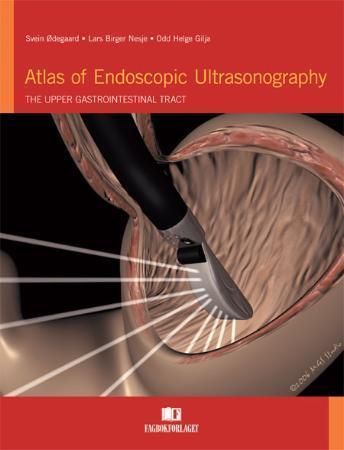 Atlas of endoscopic ultrasonography : the upper gastrointestinal tract