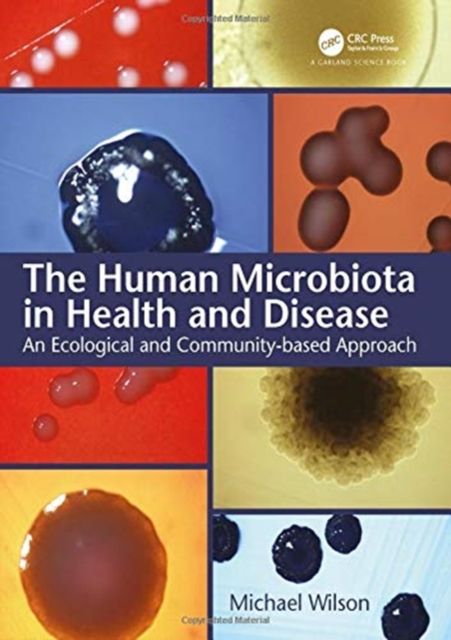 The Human Microbiota in Health and Disease : An Ecological and Community-based Approach