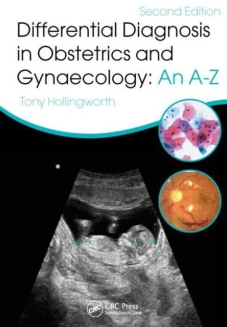 Differential Diagnosis in Obstetrics & Gynaecology : An A-Z, Second Edition