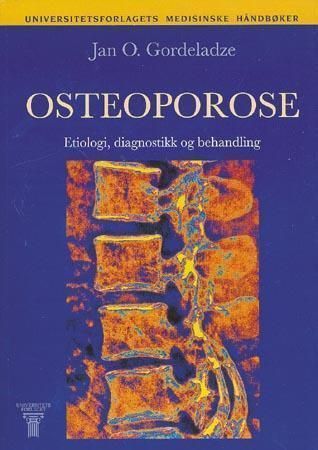 Osteoporose : etiologi, diagnose og behandling