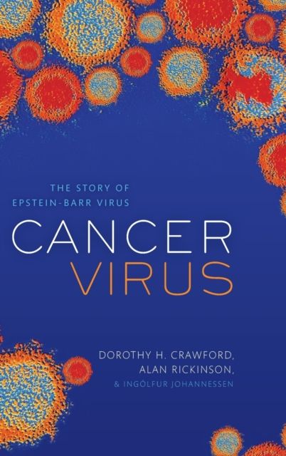Cancer Virus : The story of Epstein-Barr Virus