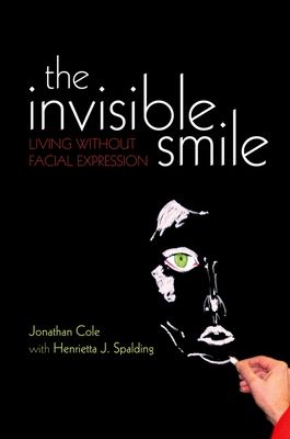 The Invisible Smile : Living without facial expression