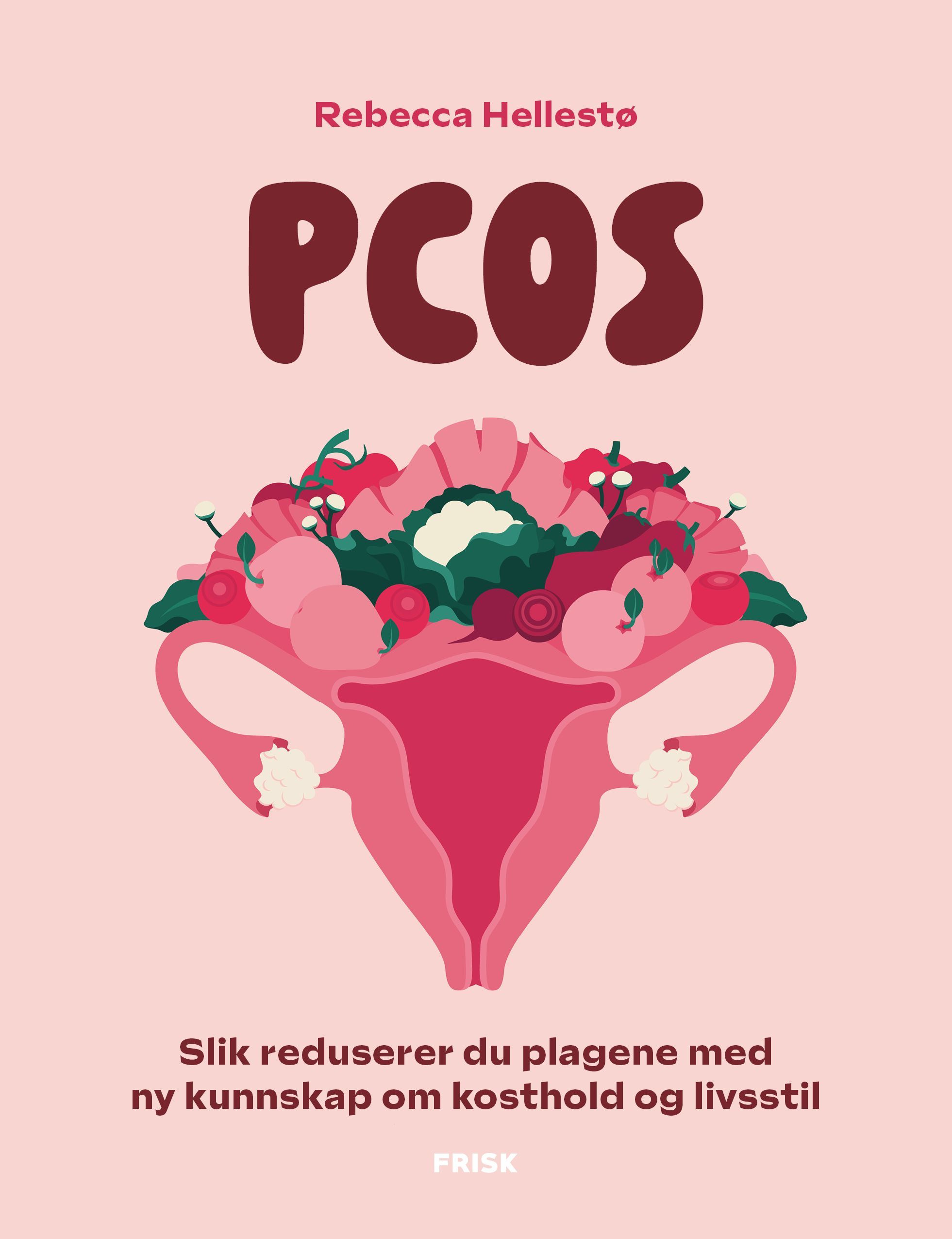 PCOS : slik reduserer du plagene med ny kunnskap om kosthold og livsstil