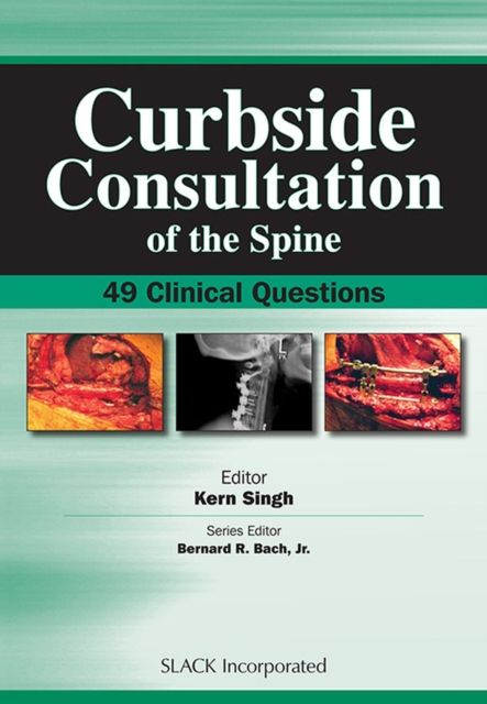 Curbside Consultation of the Spine : 49 Clinical Questions