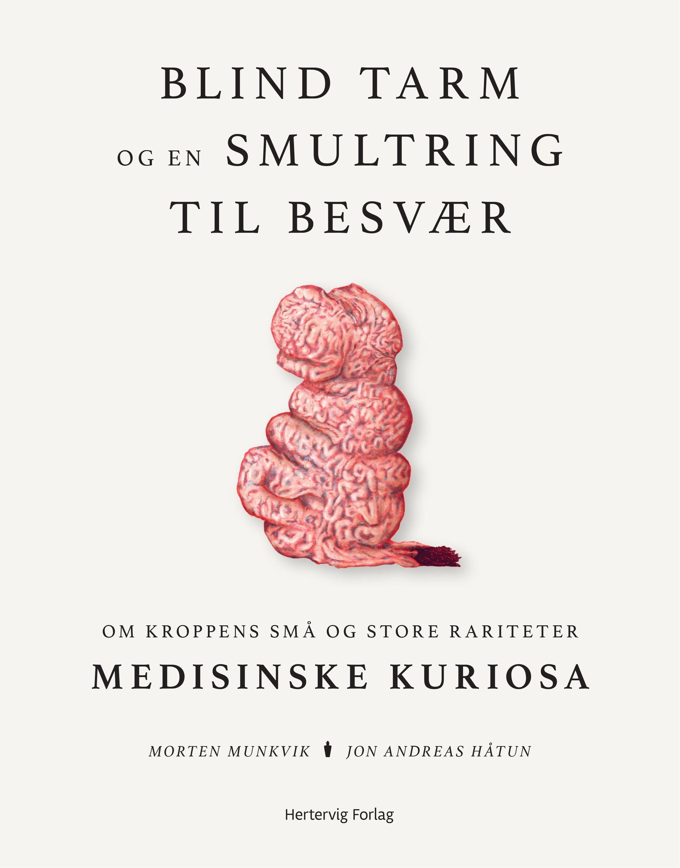 Blind tarm og en smultring til besvær : om kroppens små og store rariteter : medisinske kuriosa