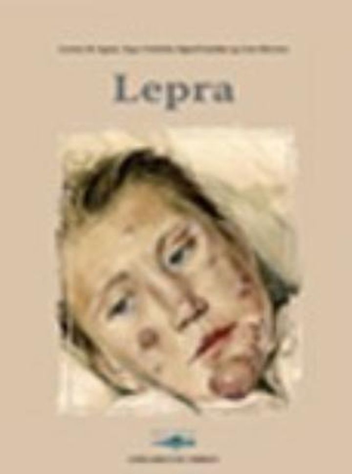 Lepra