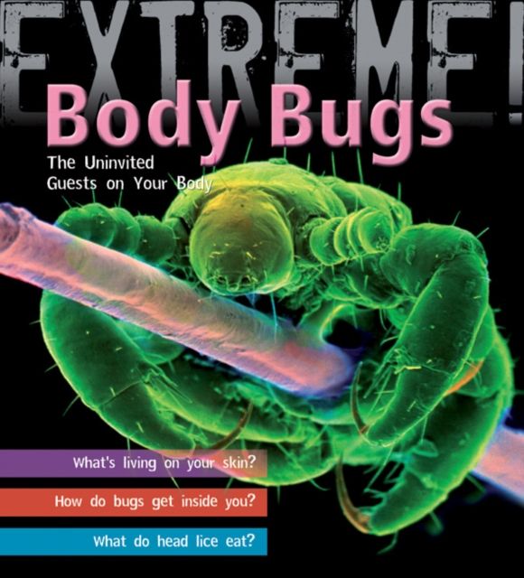 Extreme Science: Body Bugs! : The Uninvited Guests on Your Body
