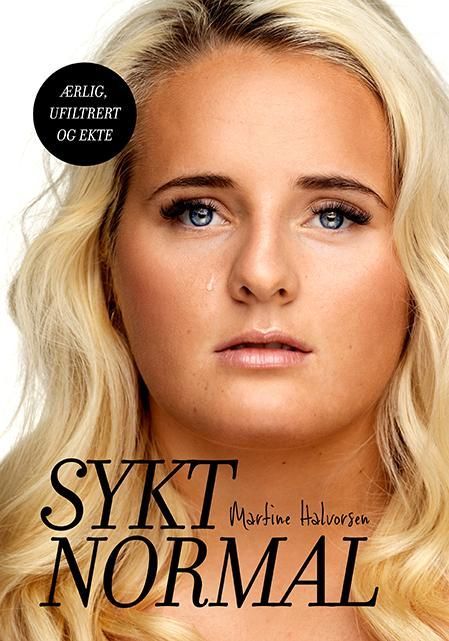 Sykt normal