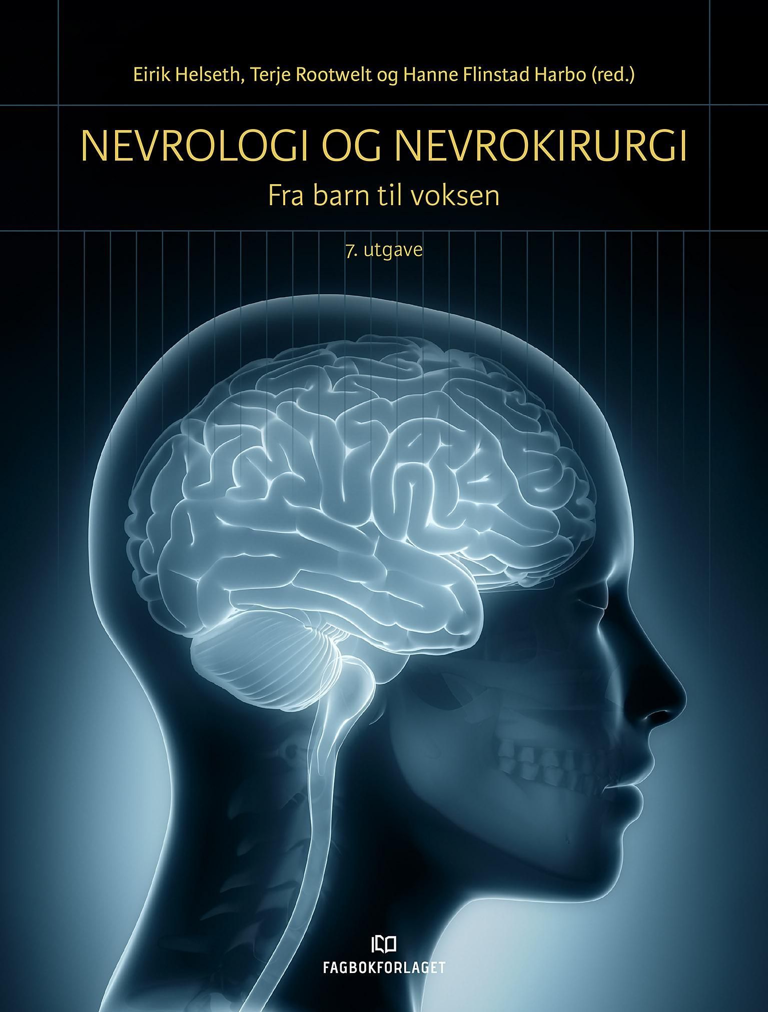 Nevrologi og nevrokirurgi : fra barn til voksen