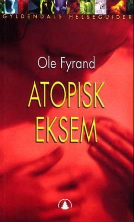 Atopisk eksem : årsaker, forløp og behandling