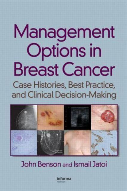 Management Options in Breast Cancer : Case Histories, Best Practice, and Clinical Decision-Making