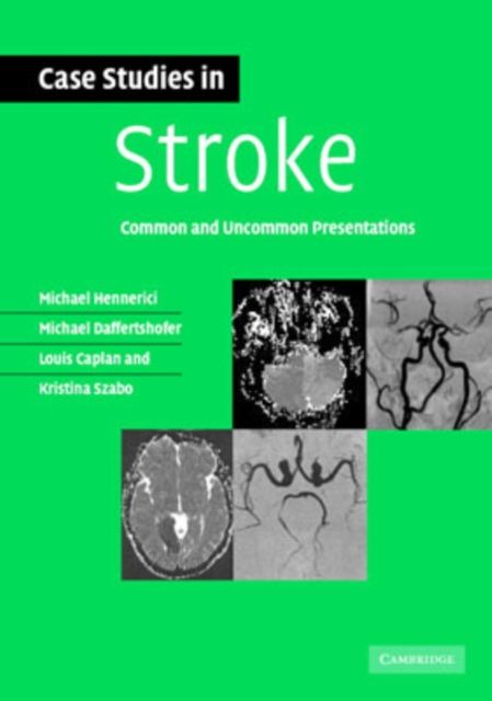 Case Studies in Stroke : Common and Uncommon Presentations