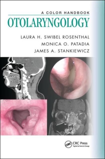 Otolaryngology : A Color Handbook