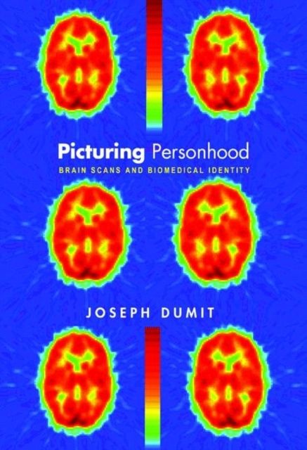 Picturing Personhood : Brain Scans and Biomedical Identity