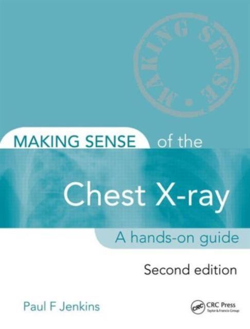 Making Sense of the Chest X-ray : A hands-on guide