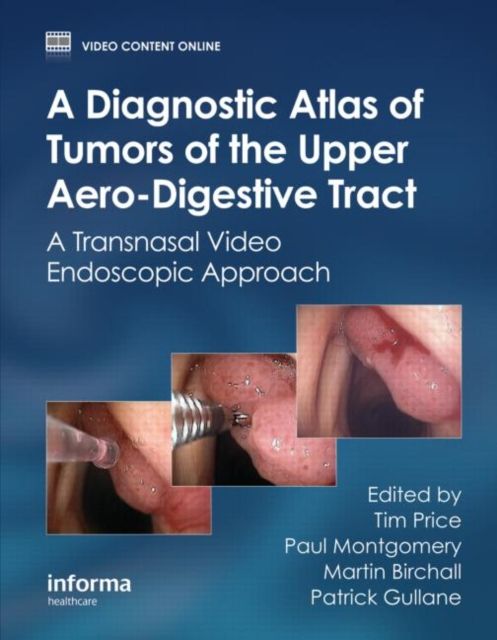 A Diagnostic Atlas of Tumors of the Upper Aero-Digestive Tract : A Transnasal Video Endoscopic Approach