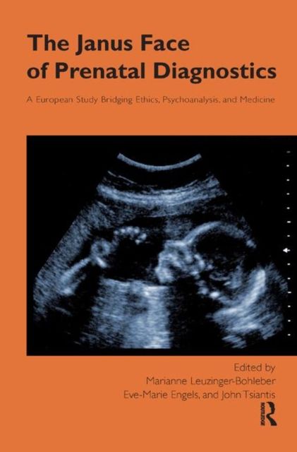 The Janus Face of Prenatal Diagnostics : A European Study Bridging Ethics, Psychoanalysis, and Medicine