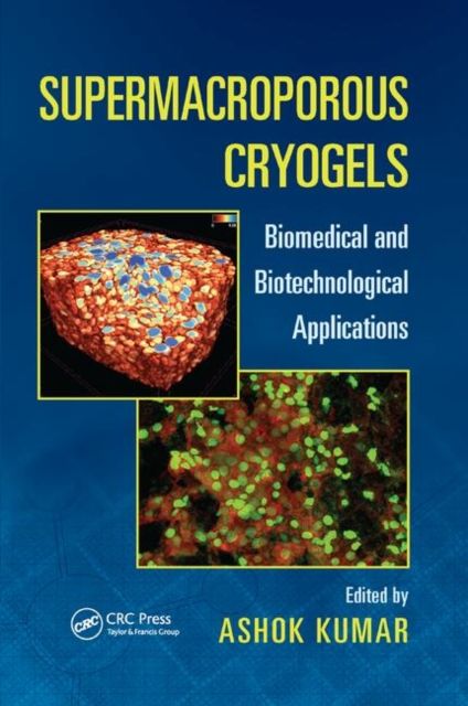 Supermacroporous Cryogels : Biomedical and Biotechnological Applications