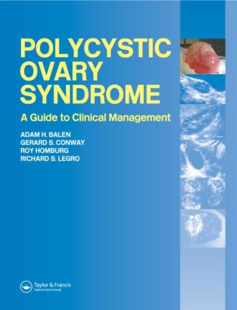 Polycystic Ovary Syndrome : A Guide to Clinical Management