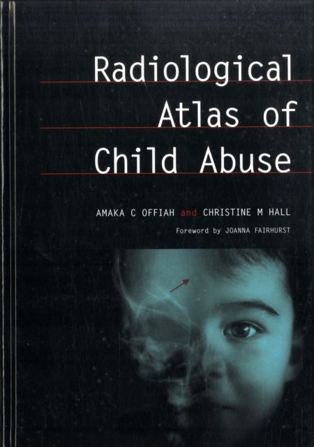 Radiological Atlas of Child Abuse : A Complete Resource for MCQs, v. 1